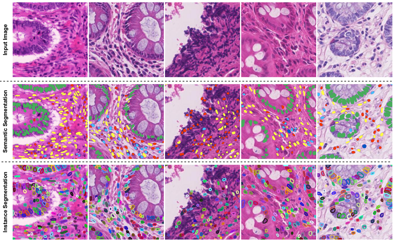 Nuclei Instance Segmentation